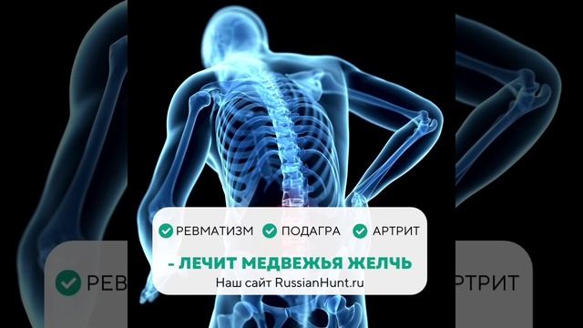 Артрит