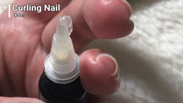 My nail care 💅巻き爪対策・割れ爪修復 смотреть онлайн
