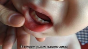 Почему появляются язвочки во рту у ребенка младше года