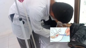 ADMINISTERING A CLEANSING ENEMA. enema procedure,