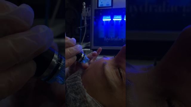 Клиника VALLISTEP Кострома , процедура: HYDRAFACIAL