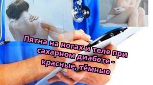 Пятна на ногах и теле при сахарном диабете - красные, тёмные