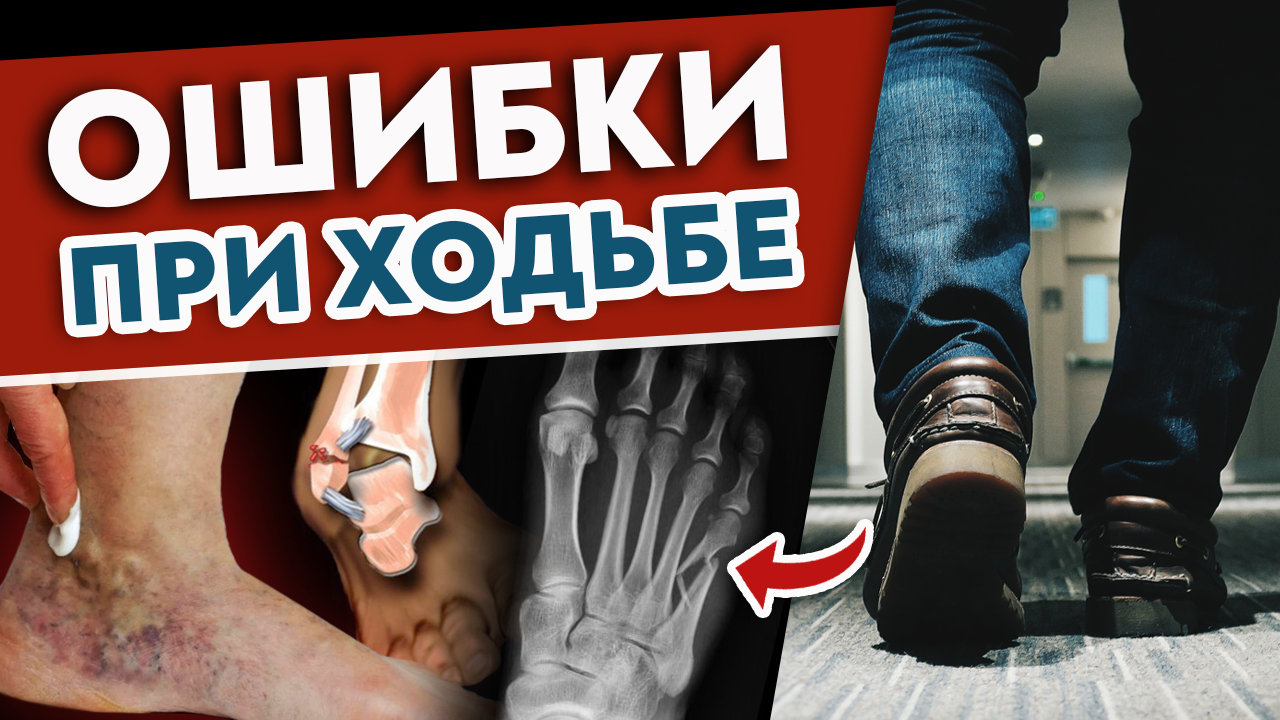 5 ошибок походки УБИВАЮТ организм! Срочно учимся правильно ХОДИТЬ!