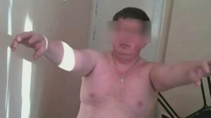 Миоклонус Фридрейха