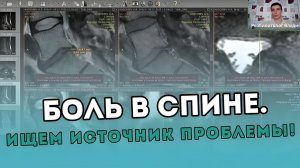 БОЛИТ СПИНА? Открываем секреты - как найти источник проблемы!