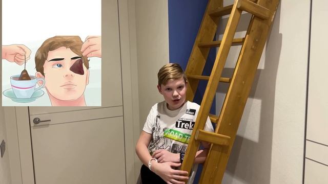 ЯЧМЕНЬ на глазу или ПИСЯК. Что делать? Как лечить? смотреть онлайн