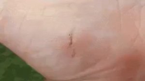 Так заживает рана на ускоренной съёмке