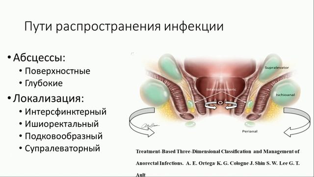 Гнойные заболевания кожи и мягких тканей