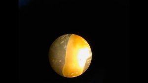 Паразиты в рыбе. Окунь.