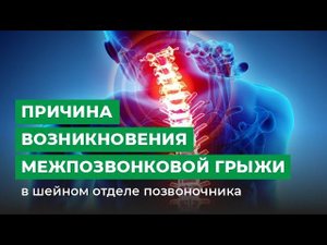 В чем причина возникновения грыж межпозвонковых дисков в шейном отделе позвоночника