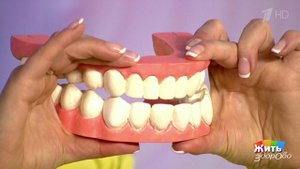 Люминиры. "Голливудская улыбка" для всех. Жить здорово! Фрагмент выпуска от 07.02.2013