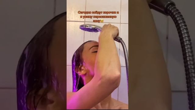 Что будет на 10 день после пересадки волос? смотреть онлайн