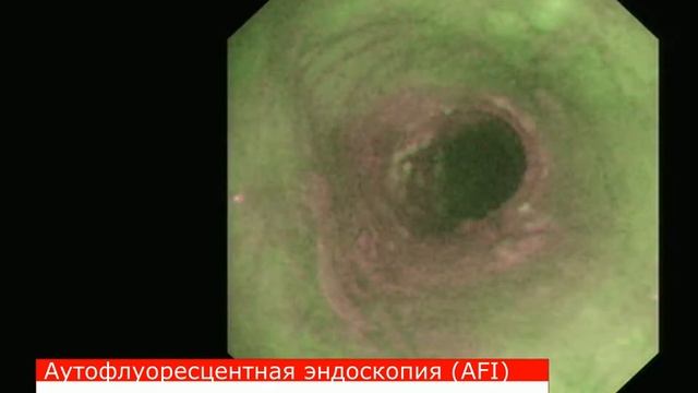 П Видео 2 смотреть онлайн