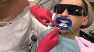 MUSIN EVERYDAY | Отбеливание зубов мой опыт, ответы врача, почему бывает больно!