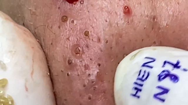 Enjoy Your Day With Hien Nguyen Spa # 1319 смотреть онлайн