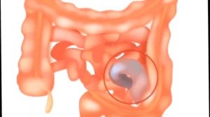 Вечером сделал, утром выпил! Как cнизить сахар в домашних условиях?