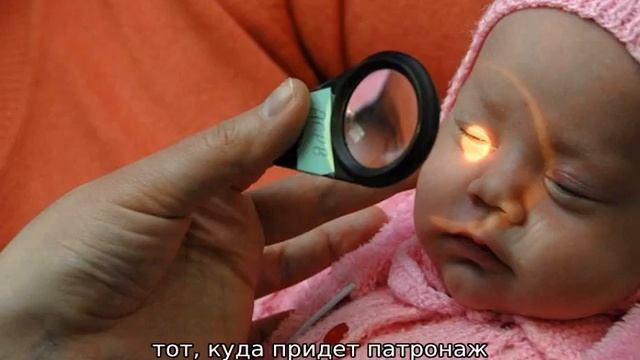 Патронаж новорожденного — образец заполнения