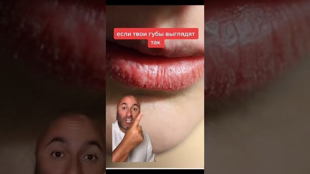 сухие губы что делать, причины, смотреть онлайн