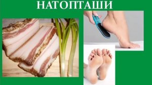 Моментально удалить натоптыши и мозоли