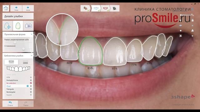 Цифровая улыбка от Просмайл.ру смотреть онлайн