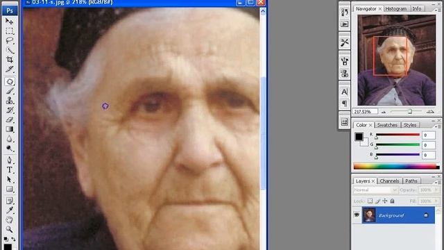 Удаление морщин на лице #14 смотреть онлайн