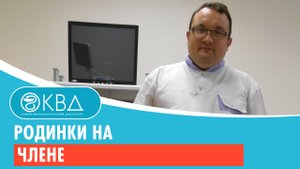 Родинки на члене. Клинический случай №105