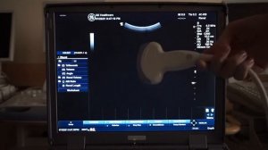 GE Logiq e (BT07) обзор ультразвукового сканера