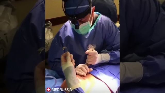 Ввод имплантов смотреть онлайн