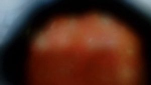 Еда диабетика. Идеальное блюдо для диабетиков томатно-луковый суп-пюре на курином бульоне.