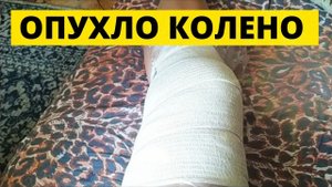 Опухло колено после нагрузок. Что делать