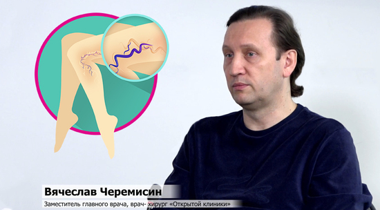 Врач-хирург Вячеслав Черемисин раскрыл причины возникновения варикозной болезни