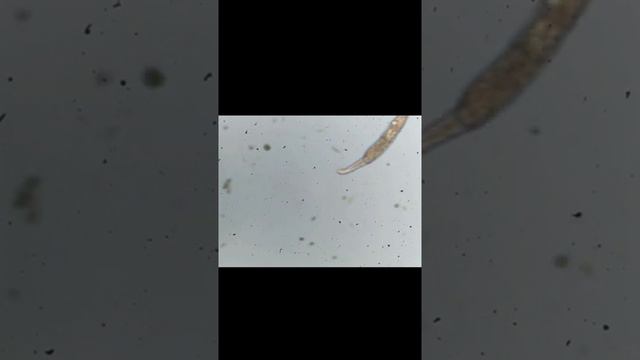 Micro-organisms in a Drop of Water