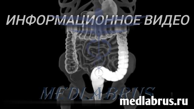 Процедура бариевой клизмы