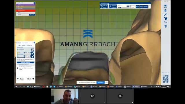 Basic CAD Design using Ceramill Mind (Exocad) - Elie El Khoueiry смотреть онлайн