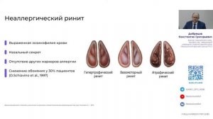 «Нарушение обоняния. Основные причины и частота возникновения»