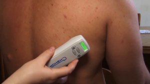 ЧЭНС-01-"Скэнар"-М. Подбор энергии воздействия