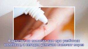 Как остановить кровь при порезе: универсальные советы