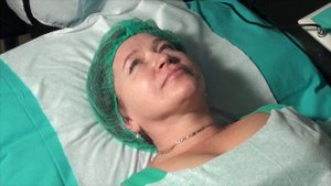 Проведение процедуры ультразвуковой чистки лица на аппарате ЭСМА Пилинг