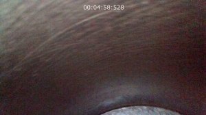 Эндоскопия двигателя G4GC Kia Ceed ED