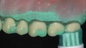 Электрические зубные щетки Oral-B, купить в интернет-магазине Zubizub