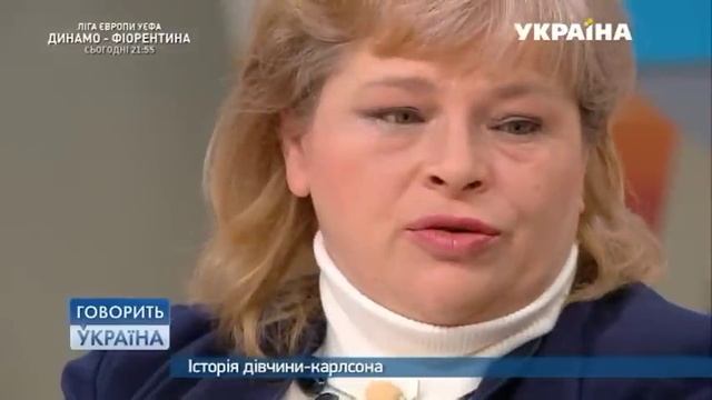 История девушки-карлсона (полный выпуск) | Говорить Україна