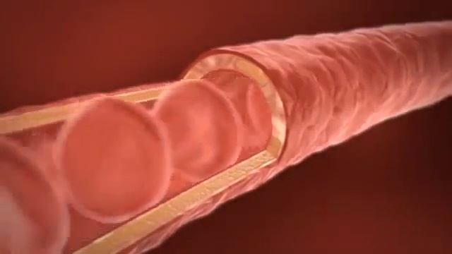 Алоэ Вера-БАРБАДЕНСИС МИЛЛЕР смотреть онлайн