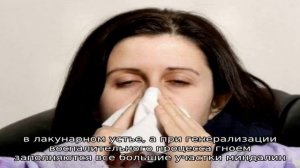 Гнойная ангина у взрослых