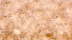 Финики. Проверка на рост грибка. Под микроскопом