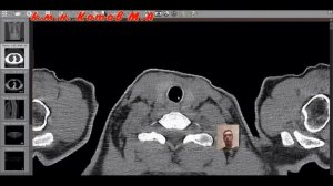 Методика анализа КТ легких.