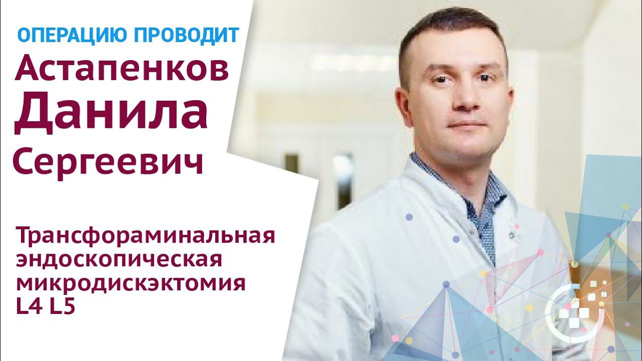 Трансфораминальная эндоскопическая микродискэктомия L4 L5 смотреть онлайн