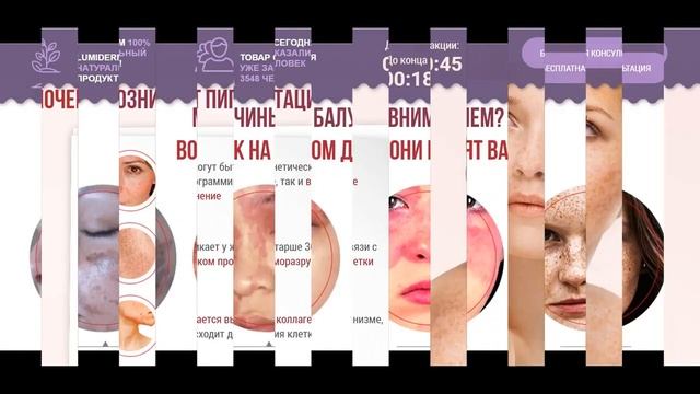 как избавиться от пигментация в домашних условиях? Шок крем от пигментации!!
