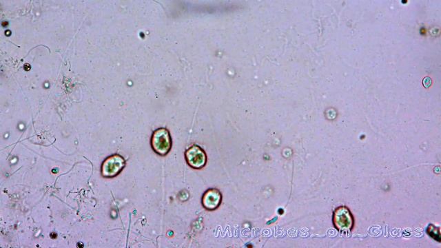 Сувойки, бактерии в прудовой воде под микроскопом. Увеличение на 10х и 40х. смотреть онлайн