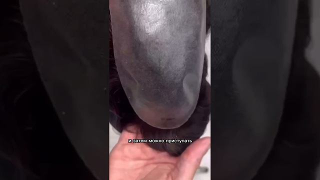 Установка системы волос