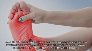 Боли в стопе сбоку с внутренней стороны